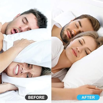 Breathing Nasal Strip Starter Kit